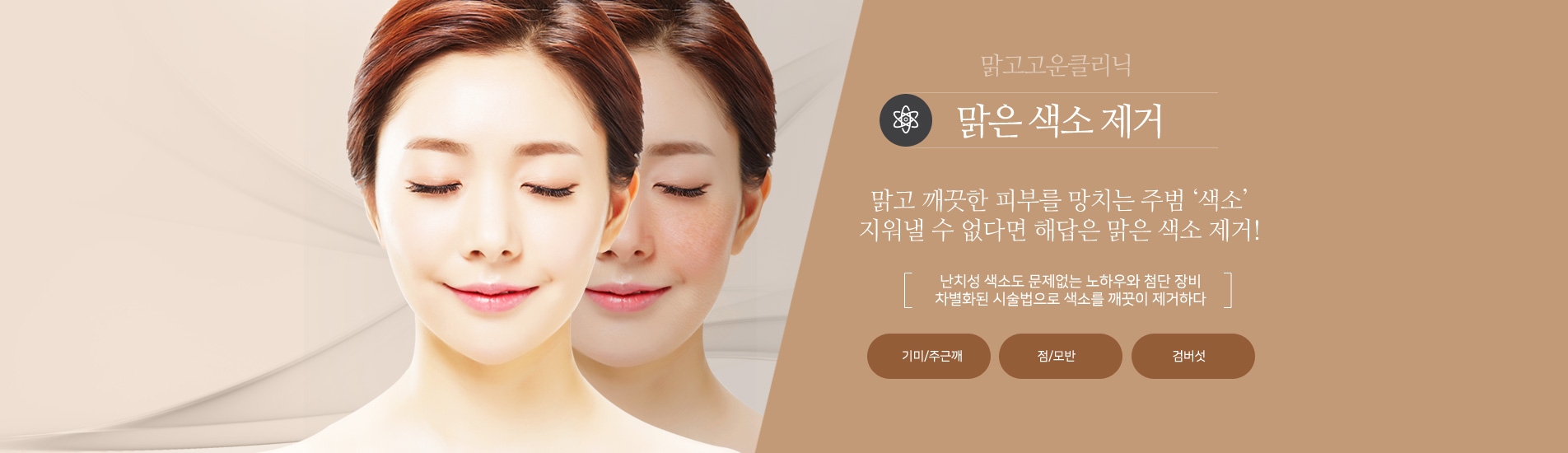 색소제거